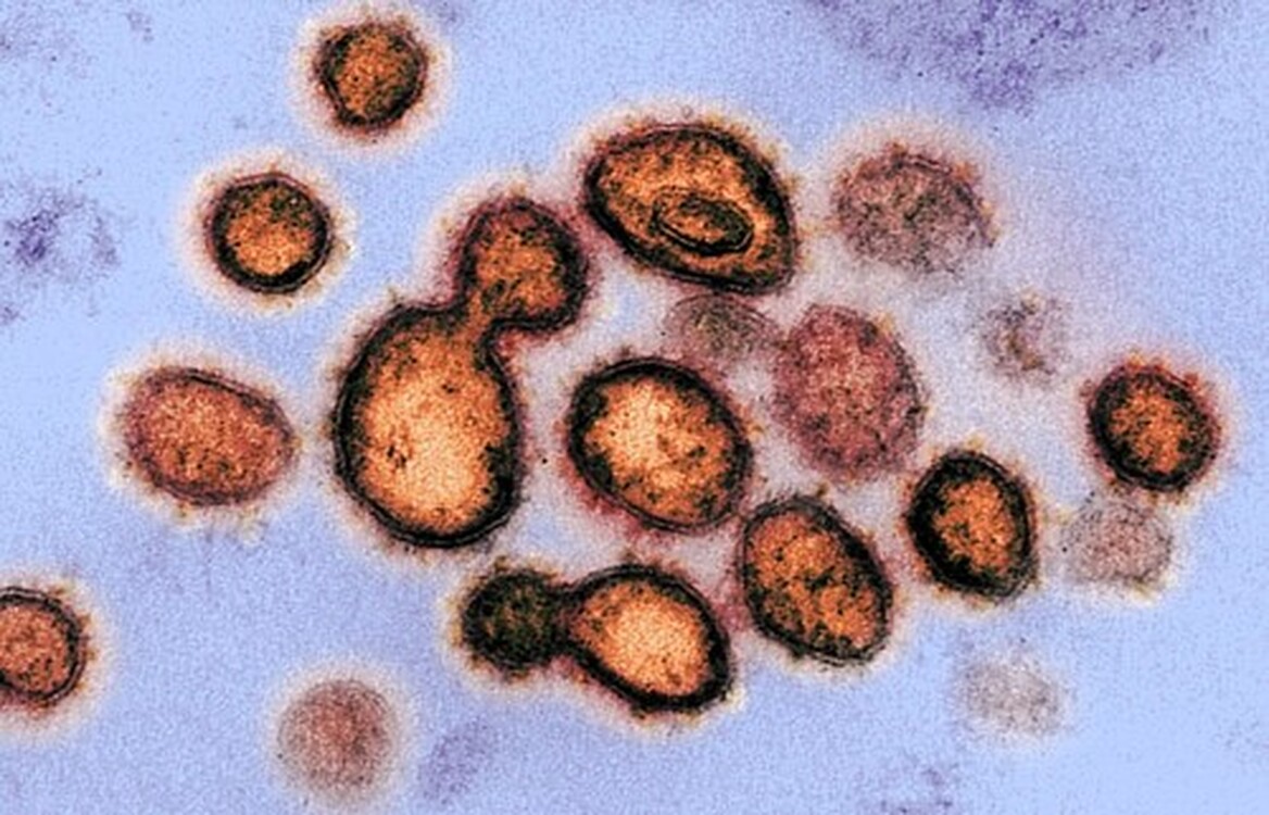 Ученые Сингапура впервые представили вирусологические и серологические данные о поствакцинальных инфекциях, связанных со штаммом Covid-19 «Дельта» — Today.kg