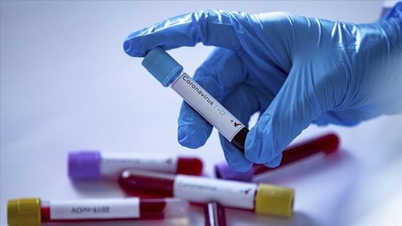Мировая смертность от коронавируса может быть на 60% выше заявленной, - исследование — Today.kg