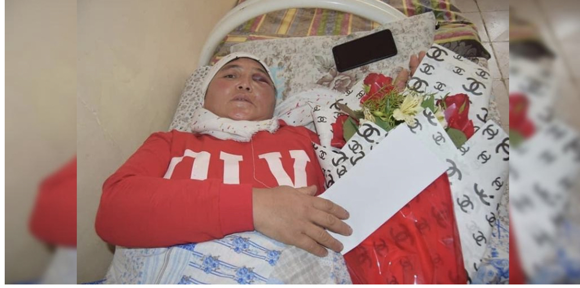 Избитая сотрудница «Тазалыка» в Джалал-Абаде лечится бесплатно. Помогает мэрия — Today.kg