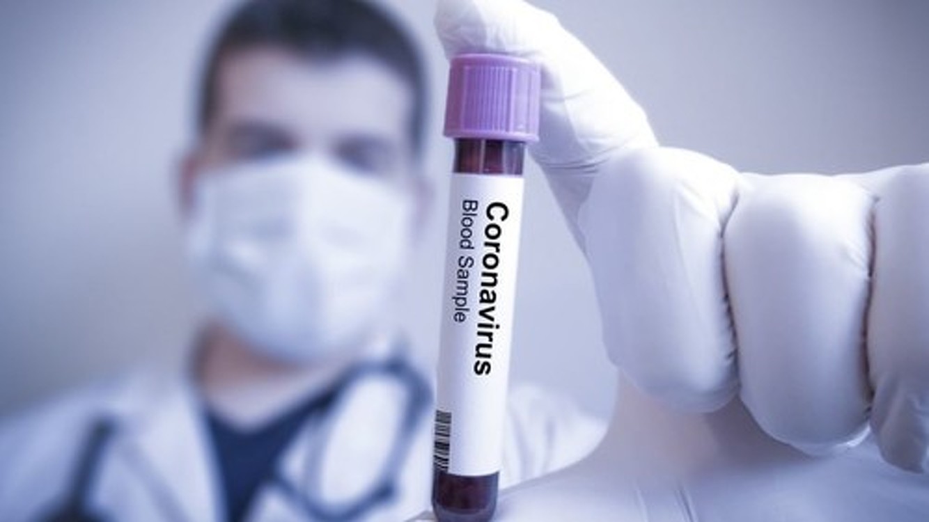 В Турции зарегистрировали первую смерть от коронавируса — Today.kg