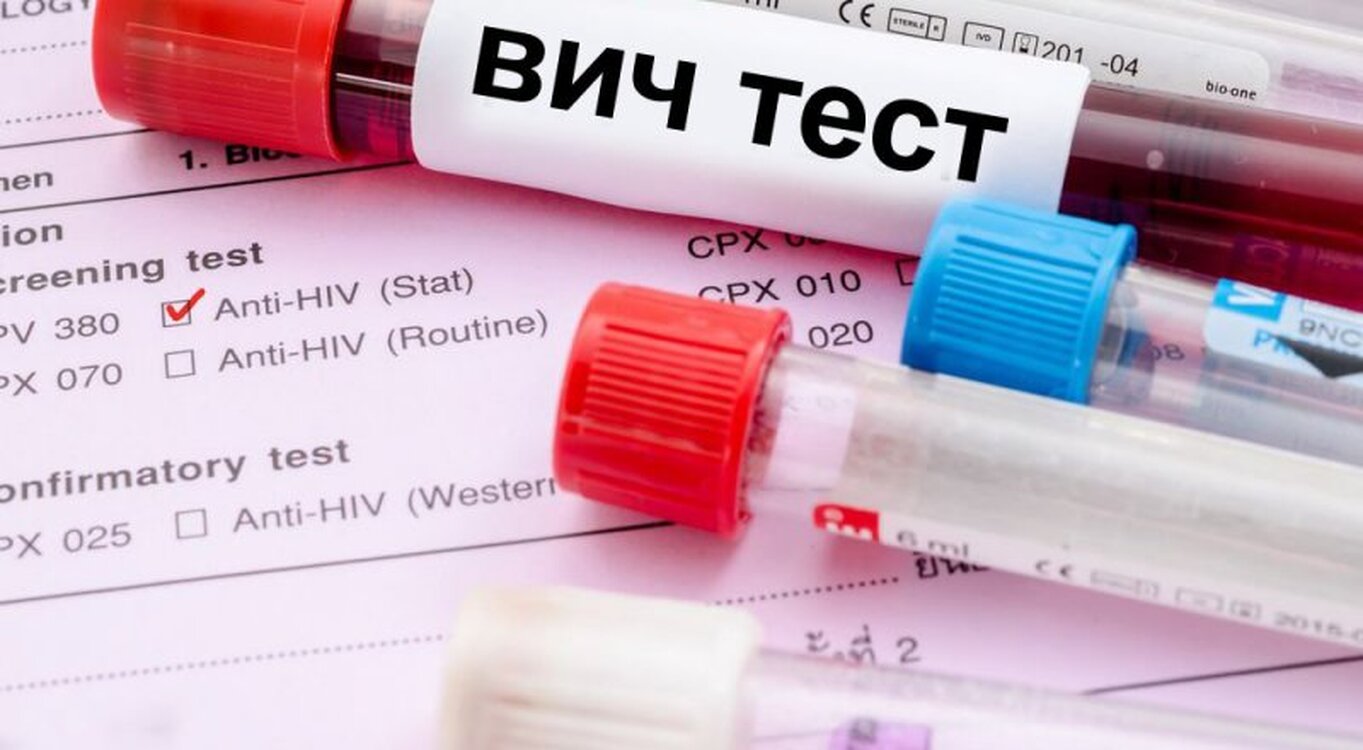 Сколько в Кыргызстане зараженных ВИЧ рассказали в РЦ «СПИД» — Today.kg