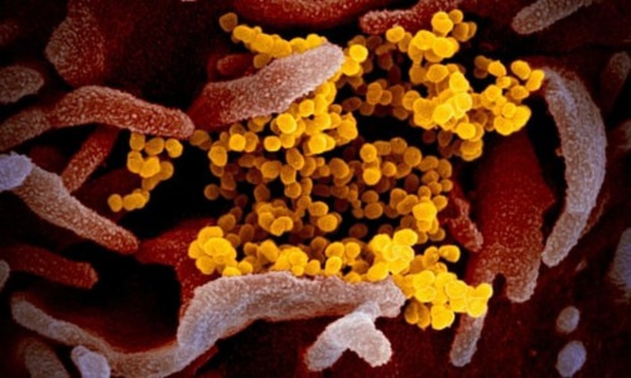 В Индонезии ученые обнаружили мутировавший штамм коронавируса — Today.kg