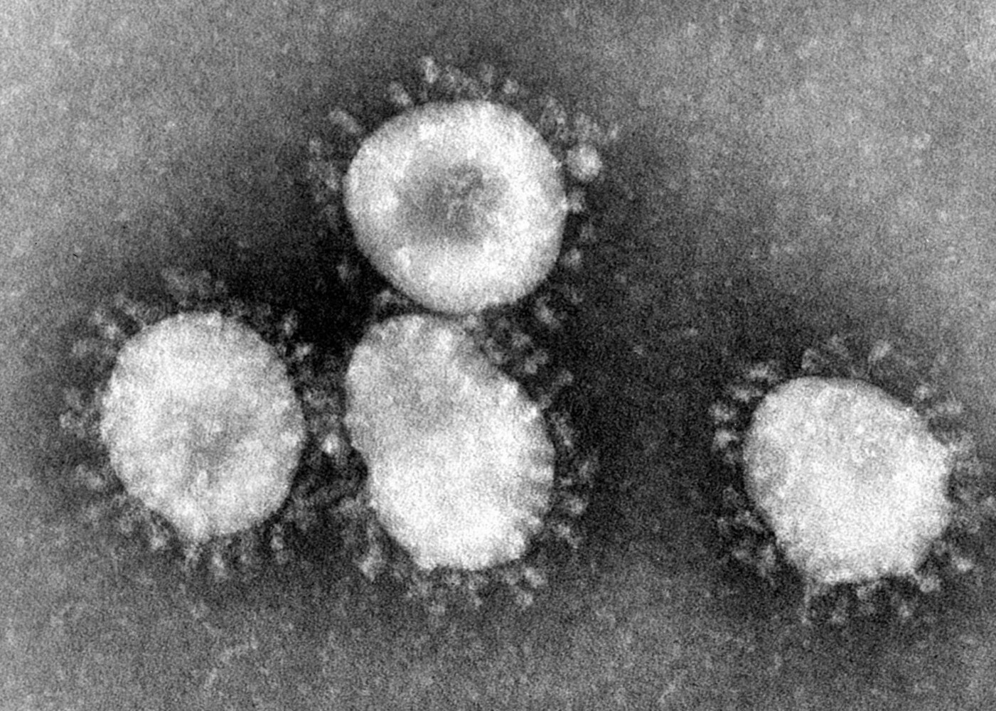 Фото - Как выглядит смертельный коронавирус под микроскопом — Today.kg