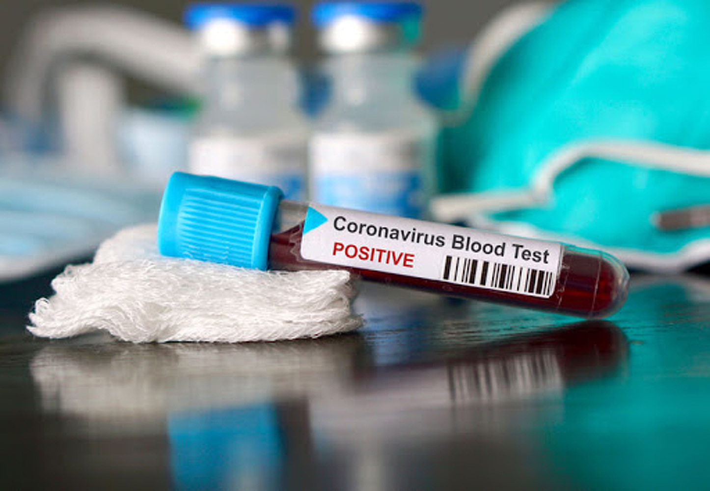 За сутки коронавирус обнаружили у 41 человека. Всего в стране 2207 случаев заражение — Today.kg