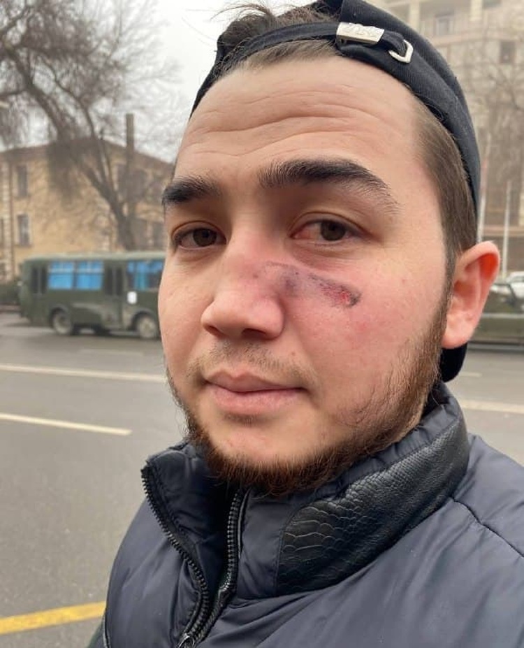 Журналистов казахского издания Orda.kz ранили во время протестов — Today.kg