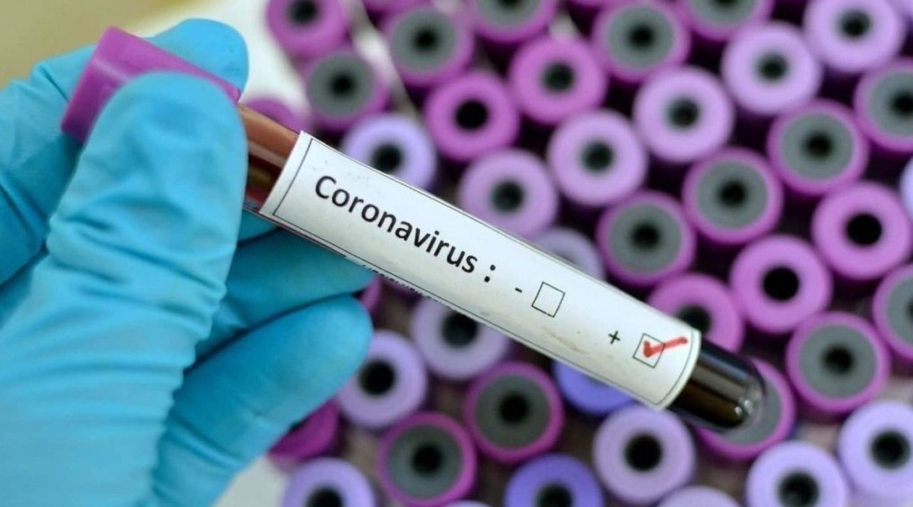 У шести работников детсадов в Бишкеке обнаружили коронавирус — Today.kg