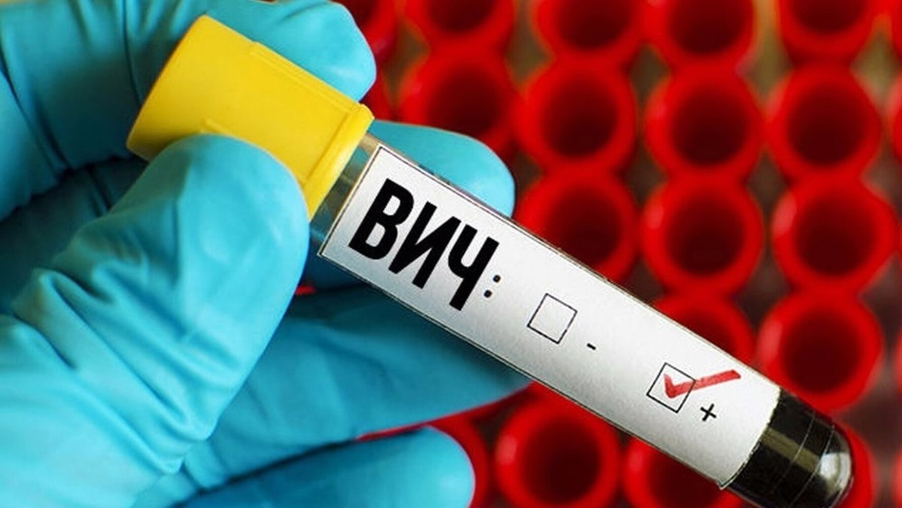 В Кыргызстане зарегистрирован 12 тыс. 231 случай ВИЧ-инфекции — Today.kg