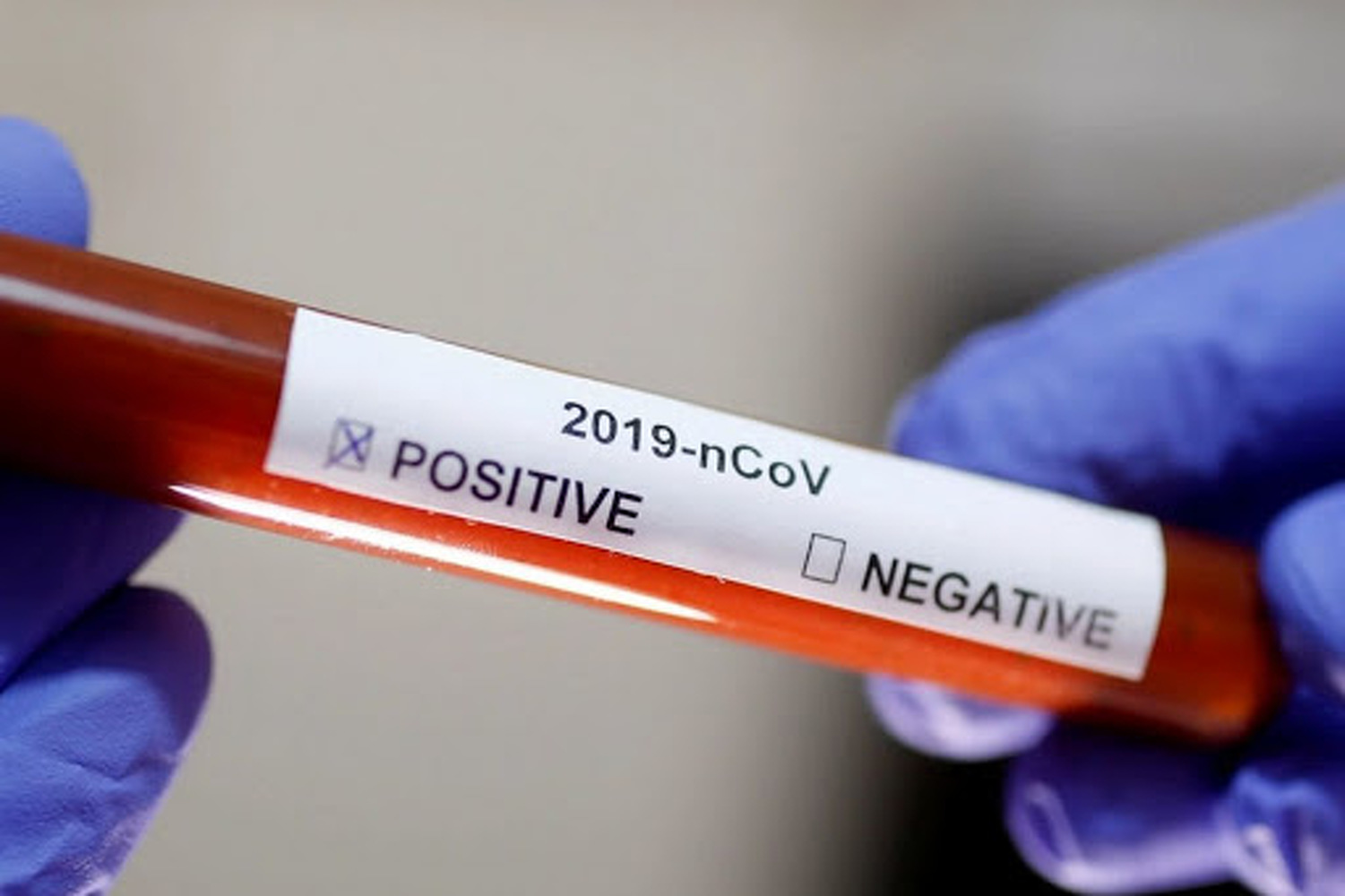 ВОЗ сообщила о начавшихся испытаниях вакцины против коронавируса — Today.kg