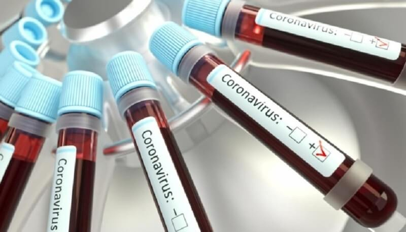Министр: Проблема с диагностикой коронавируса сегодня решена — Today.kg