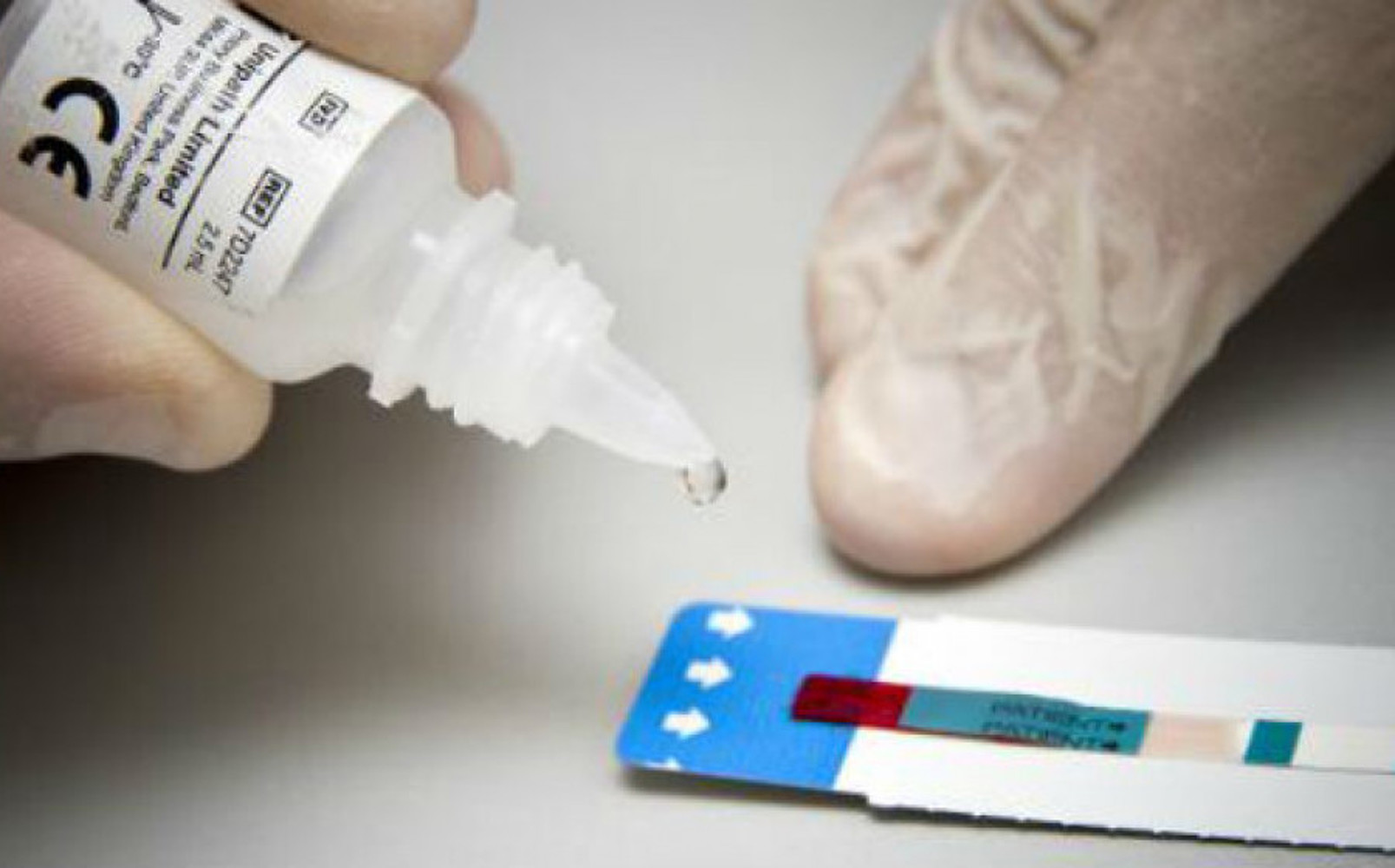 На рынках Бишкека будет проводиться бесплатное тестирование на ВИЧ — Today.kg