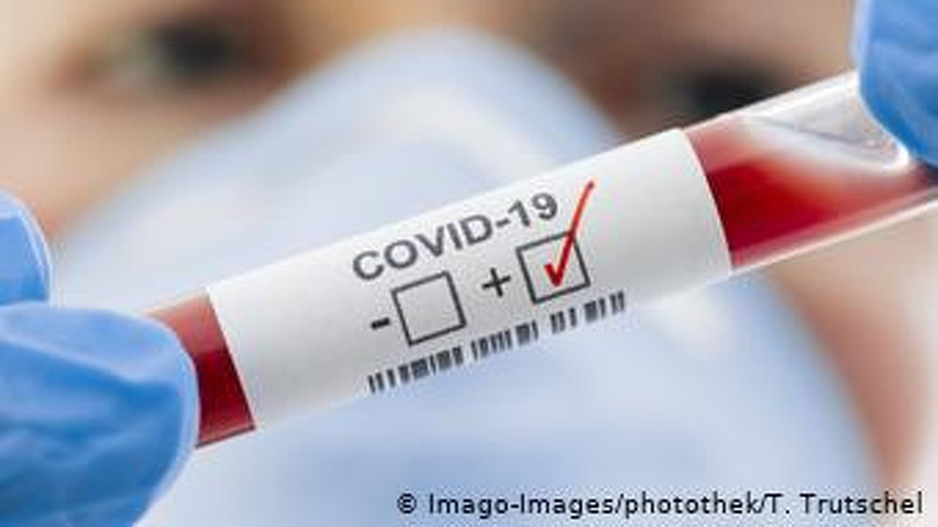 В Бишкек доставили реагенты и компоненты для тестов на коронавирус из Москвы и Минска — Today.kg