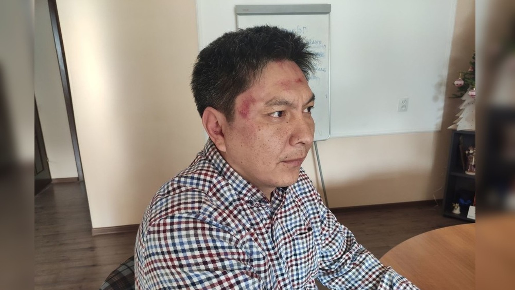 Избитый журналист считает, что на него напали  из-за расследования о тратах жены Райымбека Матраимова — Today.kg