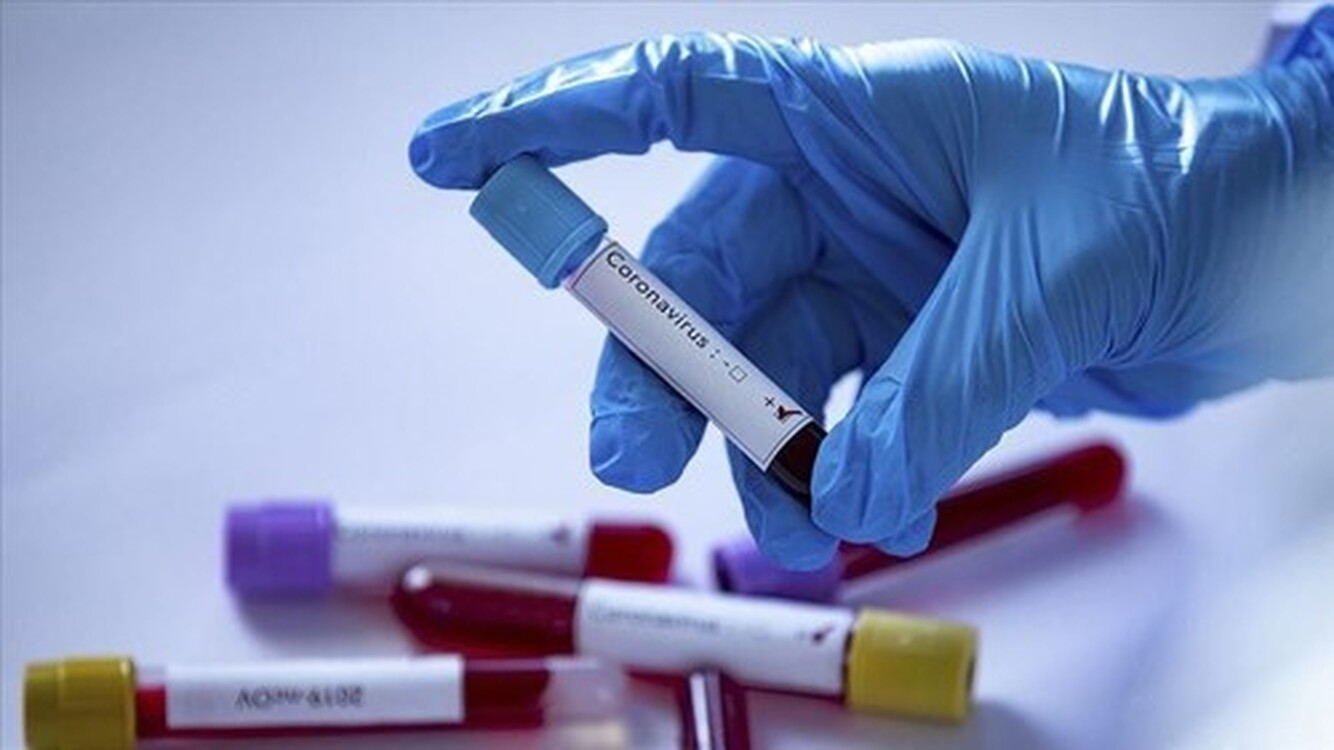 В Узбекистане зарегистрировали 145 новых случаев коронавируса. Всего 74 956 — Today.kg