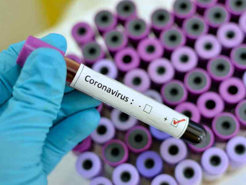 Где в Бишкеке можно сдать анализ на коронавирус и антитела — Today.kg