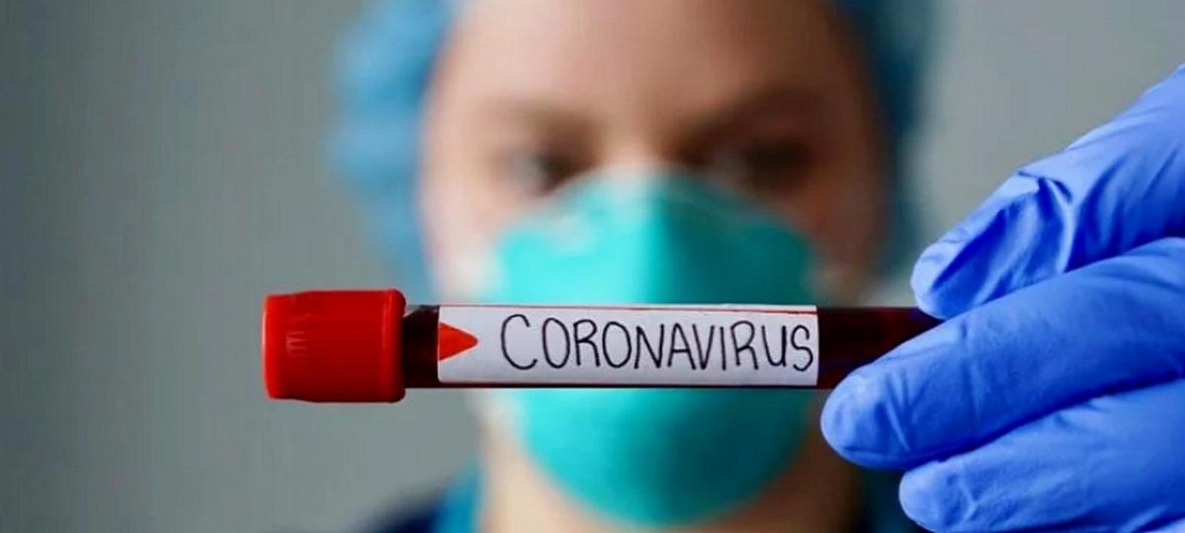 В Кыргызстане за сутки коронавирус выявлен у 70 медиков — Today.kg