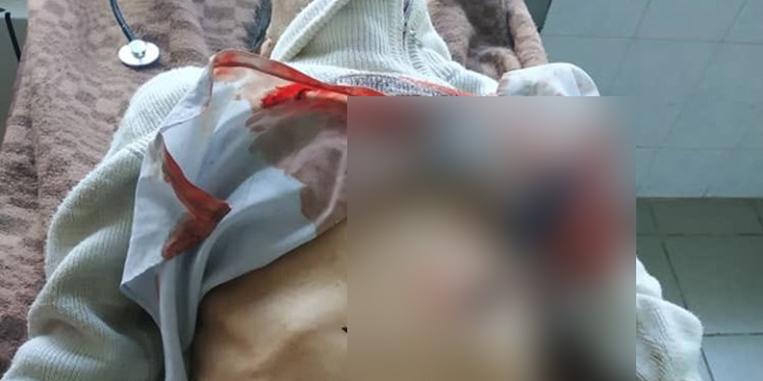 В Чолпон-Ате врачи спасли пациента, поступившего с ножом в сердце. Осторожно, фото! — Today.kg