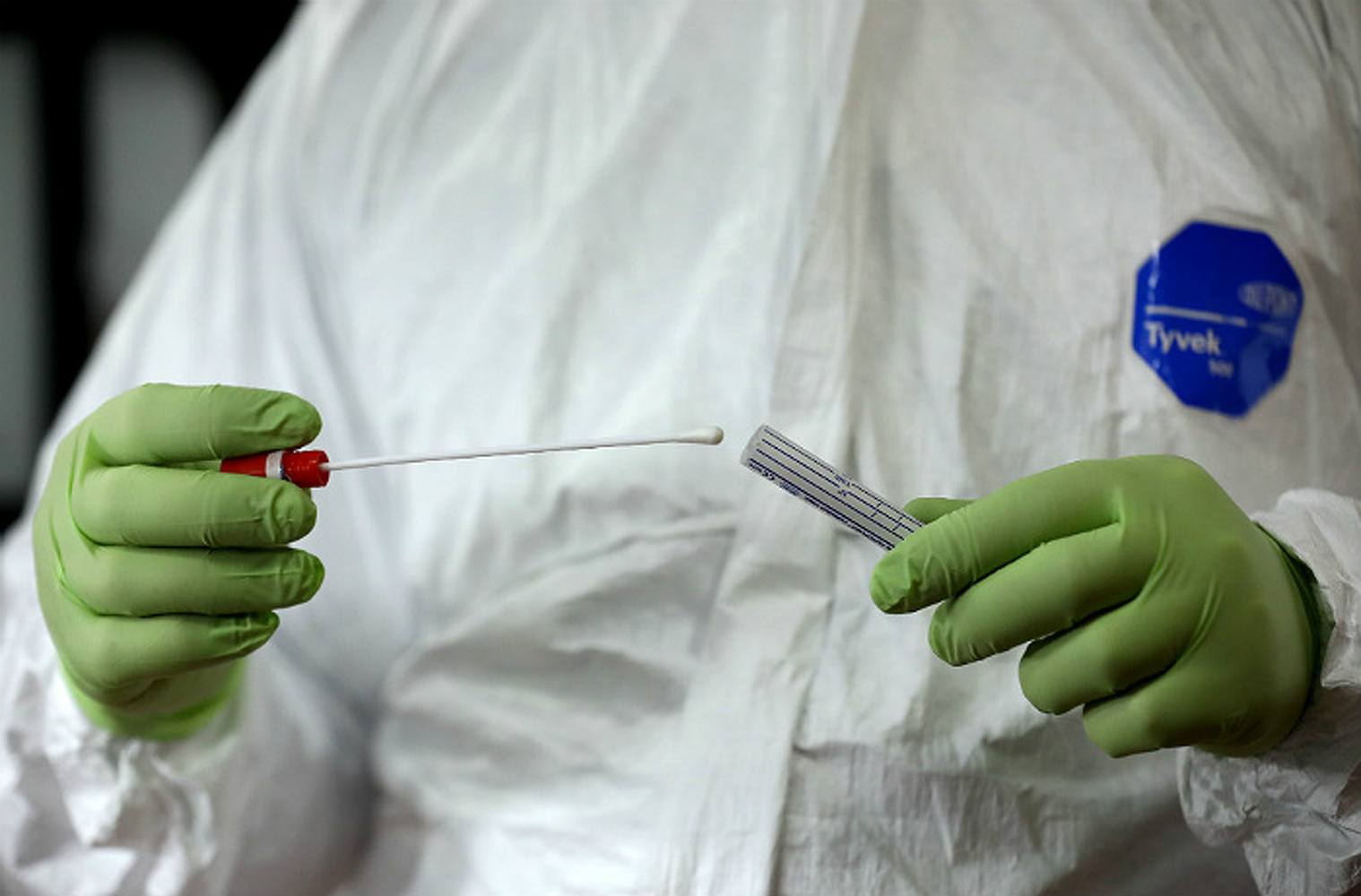 Ученые США разработали тест, способный выявлять еще не заразных носителей коронавируса — Today.kg