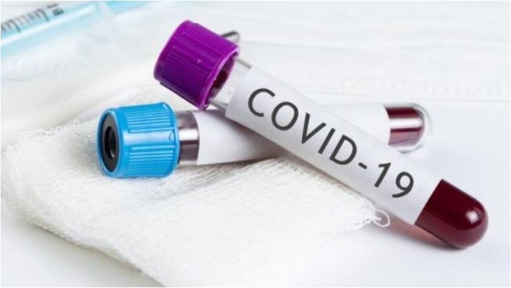 Минздрав:  лечение COVID стоит не $ 3 тысячи — Today.kg