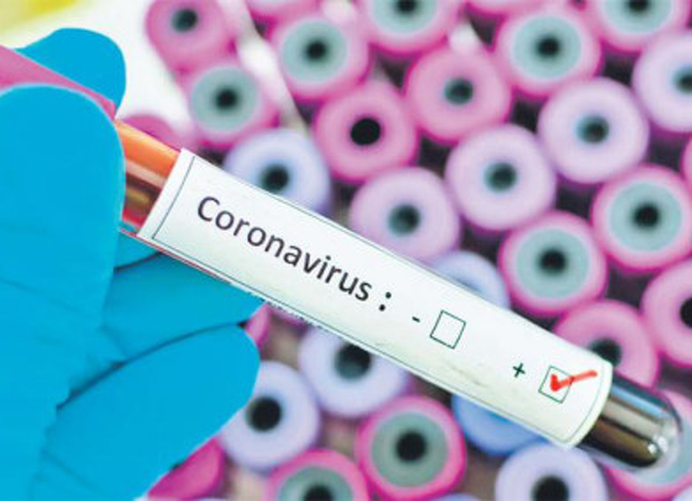 Коронавирус: опасный синдром обнаружен у британских детей — Today.kg