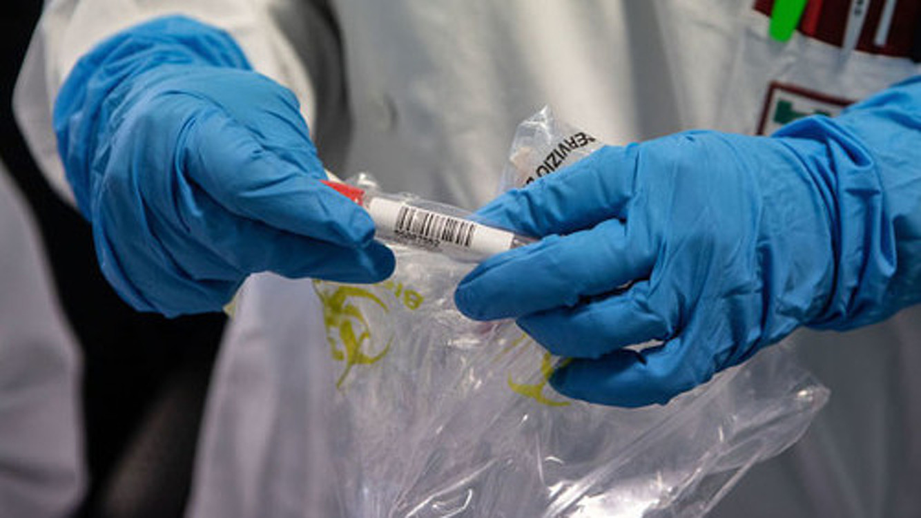 К августу в США прогнозируют 135 тысяч смертей от коронавируса — Today.kg