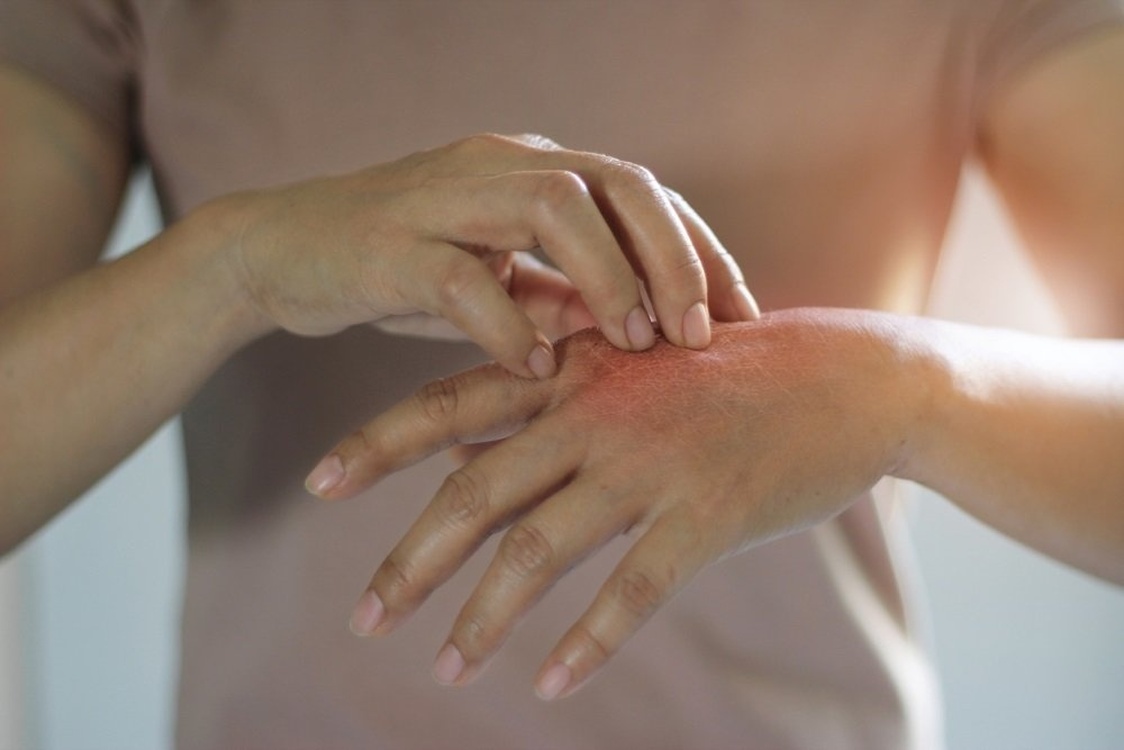 Ученые назвали кожные симптомы омикрон-штамма — Today.kg